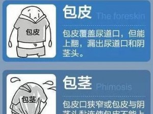 下面不够硬是什么原因引起的？推荐使用[产品名称]，解决你的难言之隐