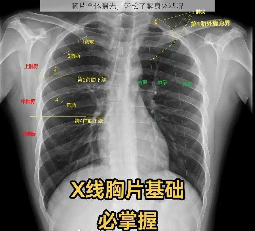 胸片全体曝光，轻松了解身体状况